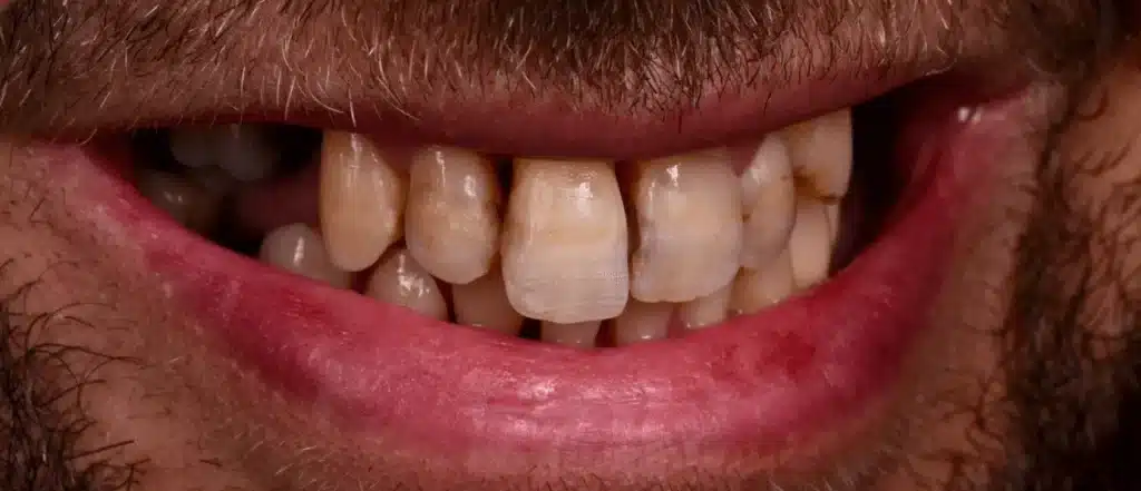 dentiste spécialisé en prothèse dentaire