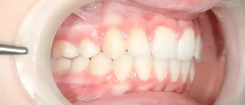 Dentiste orthodontie paris après