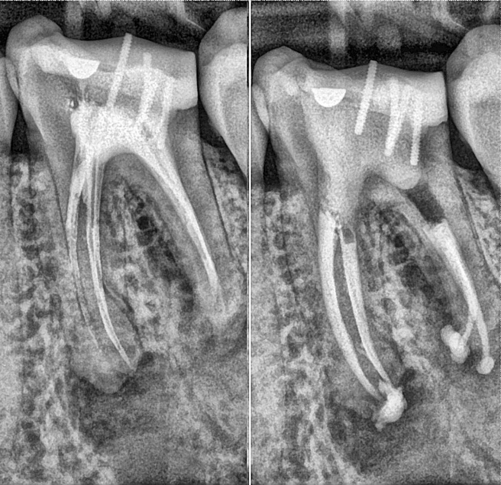 endodontie-paris